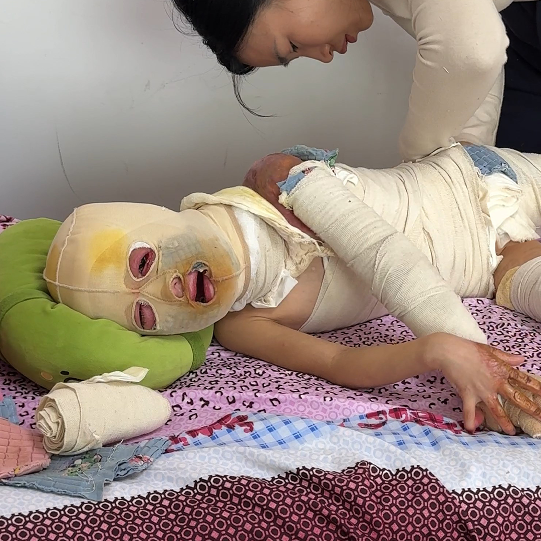 Help Protect Sharah’s Smile