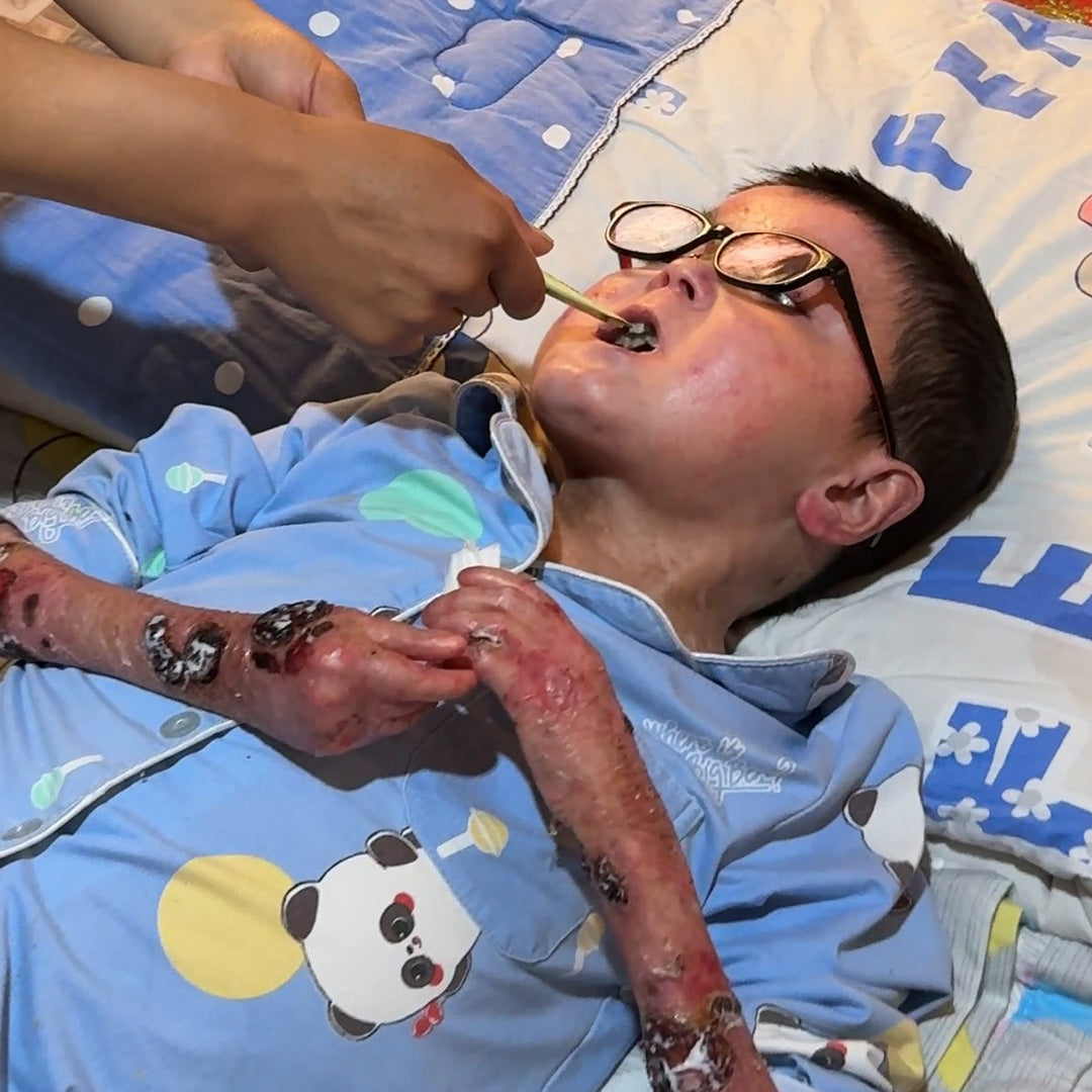 Help Little Ayi Fight Lupus