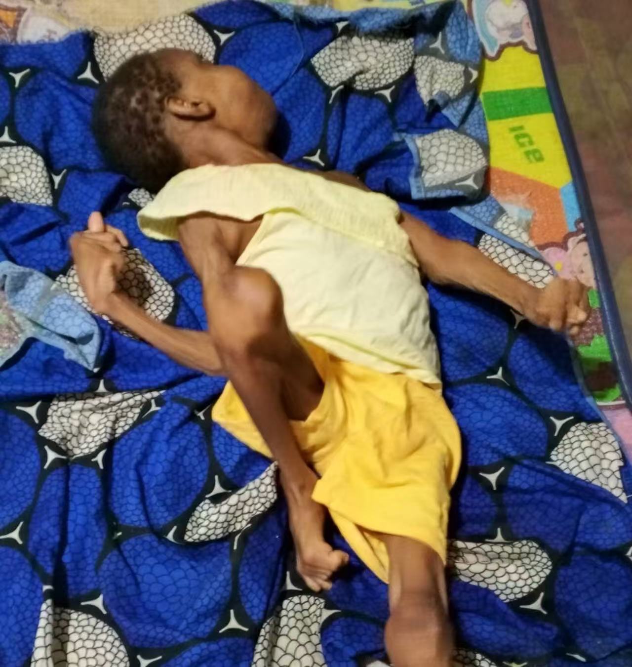 Help a Child Stand and Smile Again！