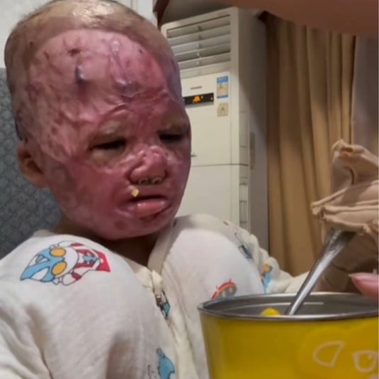 Help Clara Heal and Live Without Pain