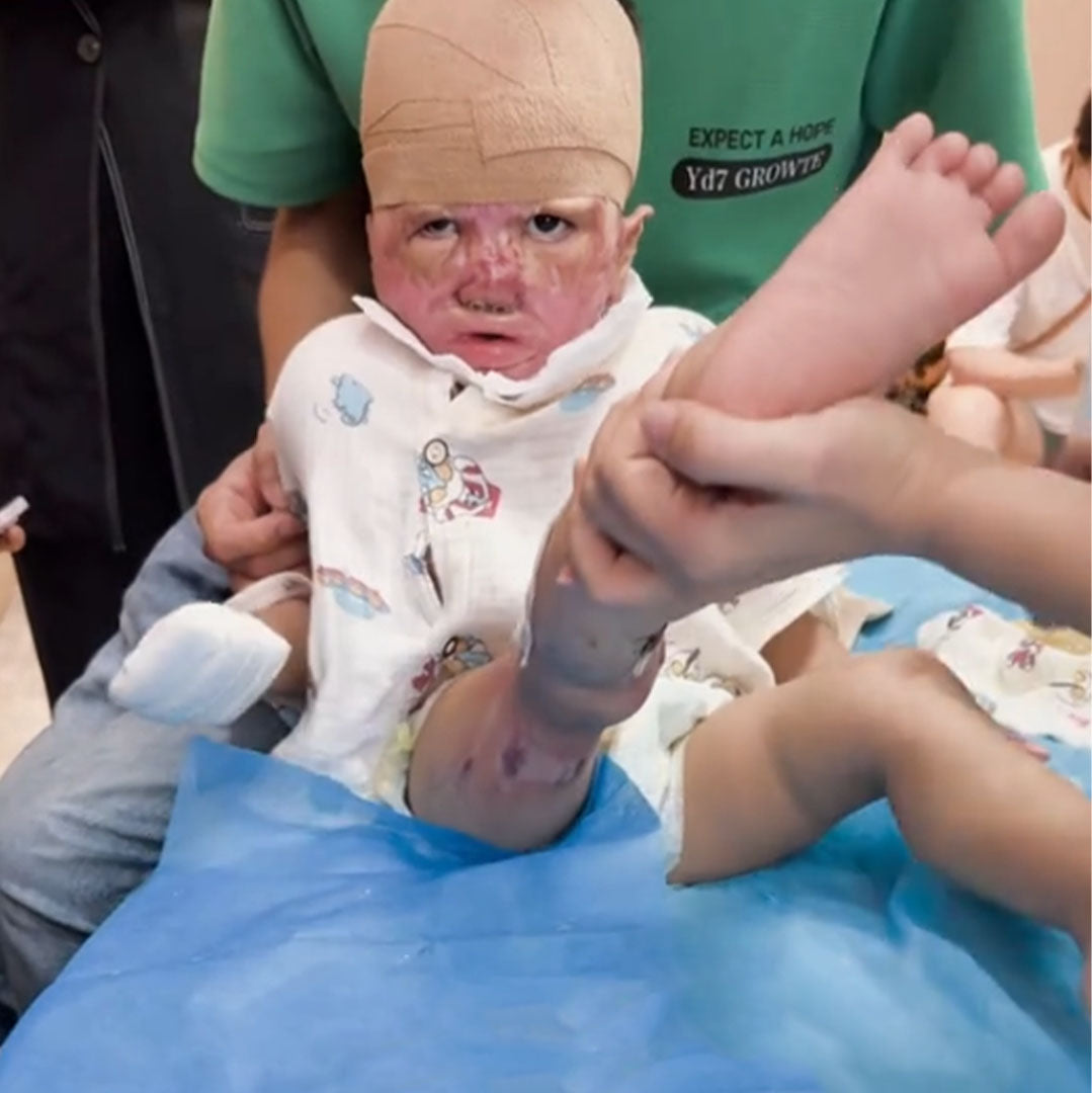 Help Clara Heal and Live Without Pain