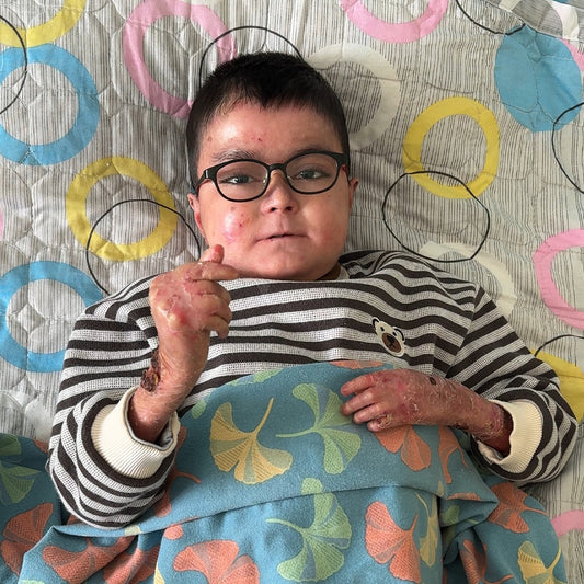 Help Little Ayi Fight Lupus