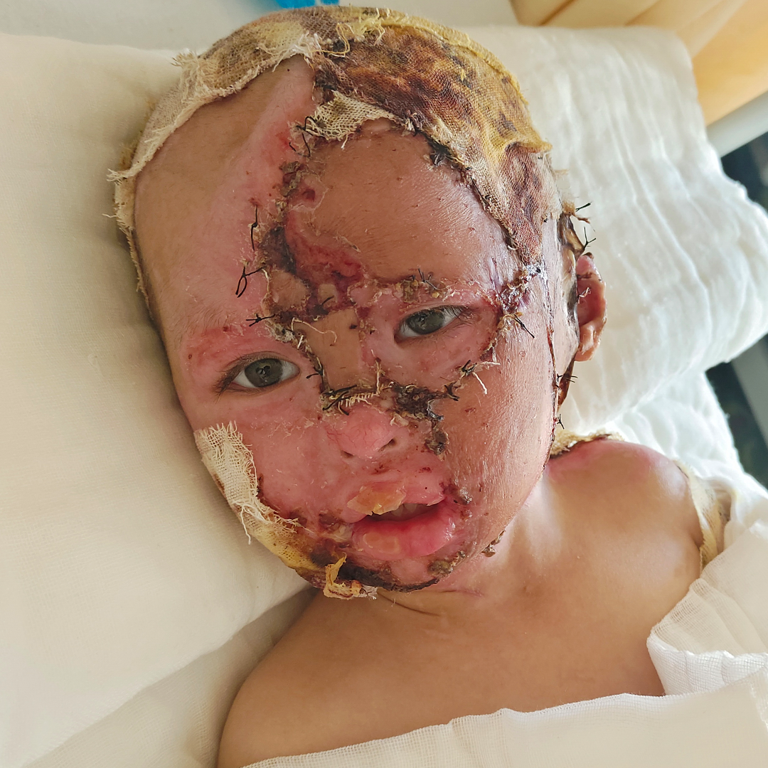 Help Clara Heal and Live Without Pain