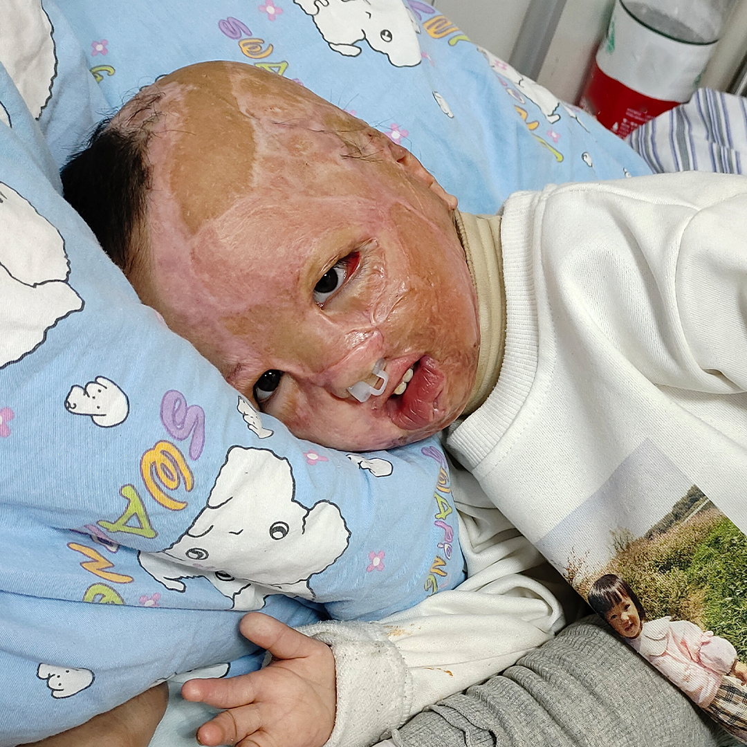 Help Clara Heal and Live Without Pain