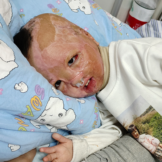 Help Clara Heal and Live Without Pain