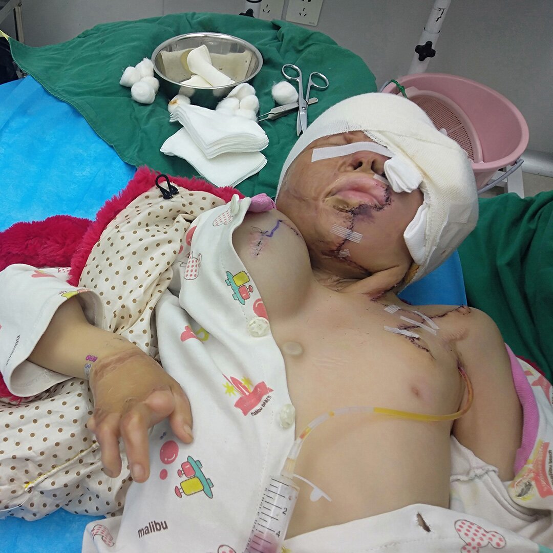 Bring hope and light to Pingping