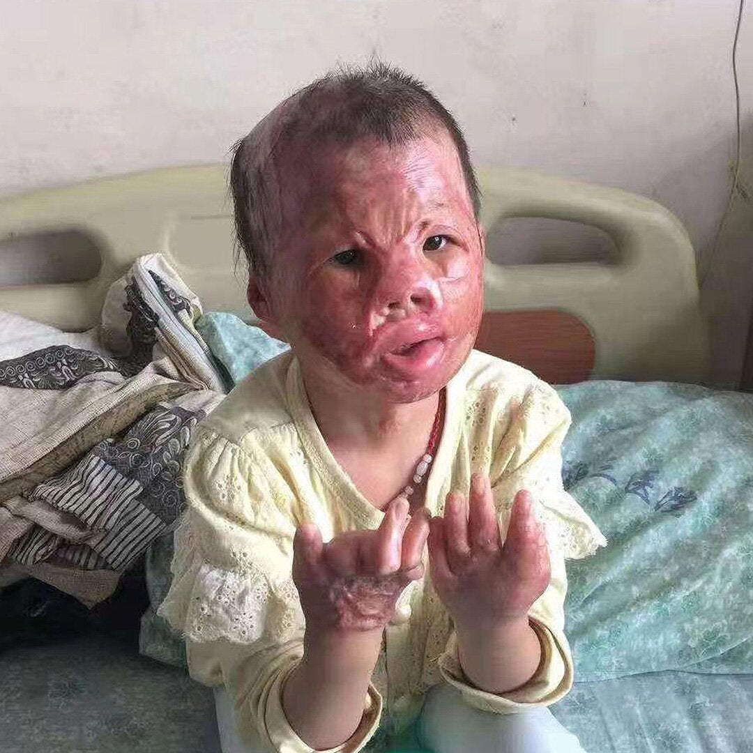 Bring hope and light to Pingping